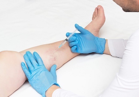 what is a varicose vein specialist called.jpg